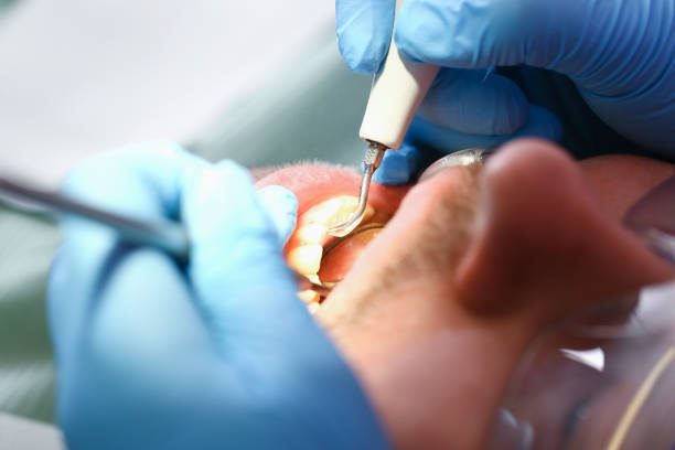 Best Dentist for Tooth Abscess  in Kenmore, WA